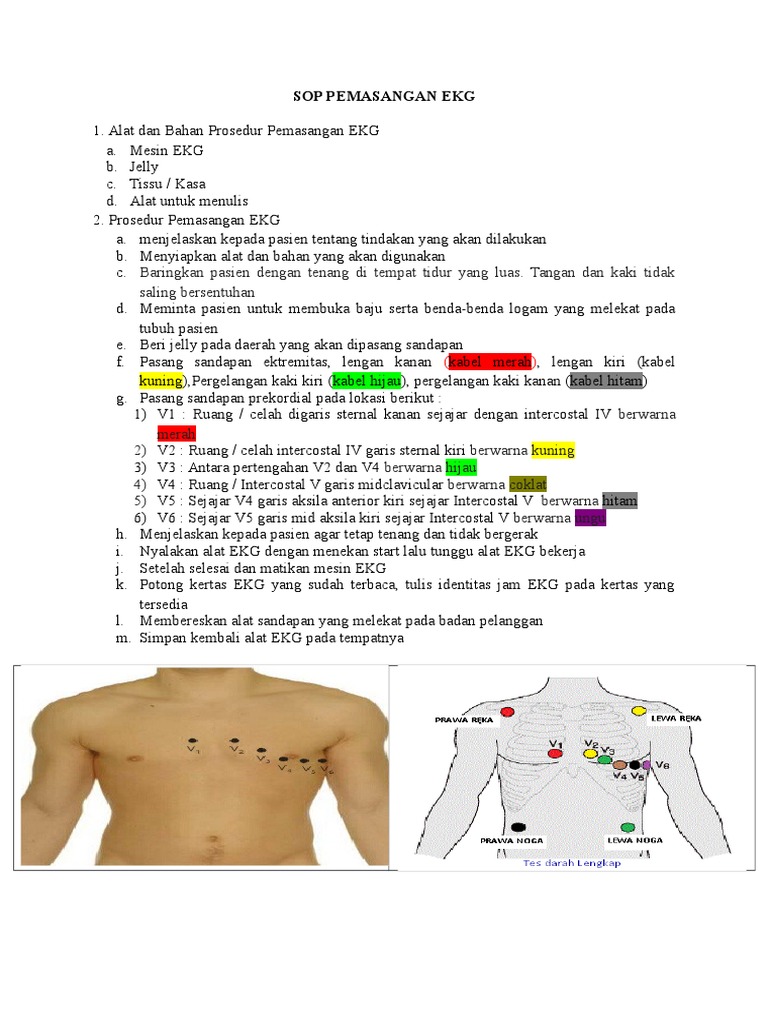 Detail Gambar Pemasangan Ekg Nomer 23