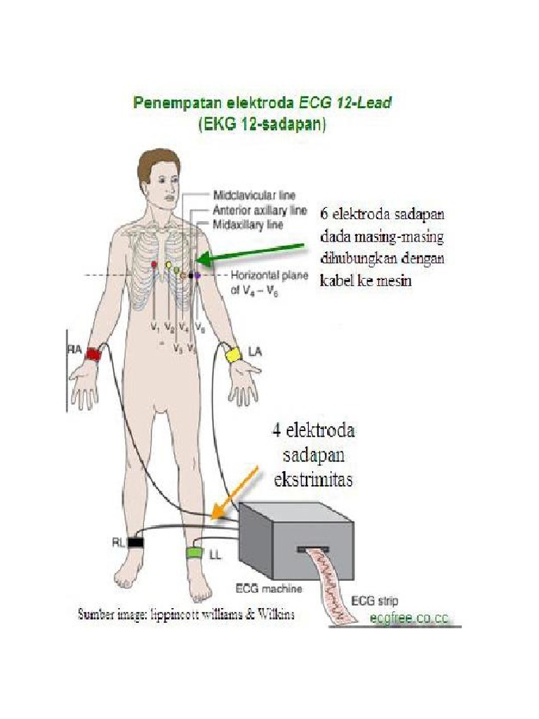 Detail Gambar Pemasangan Ekg Nomer 3