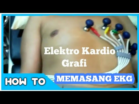 Detail Gambar Pemasangan Ekg Nomer 27