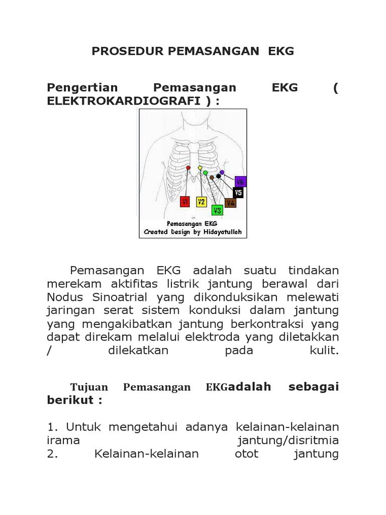 Detail Gambar Pemasangan Ekg Nomer 30