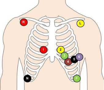 Detail Gambar Pemasangan Ekg Nomer 37