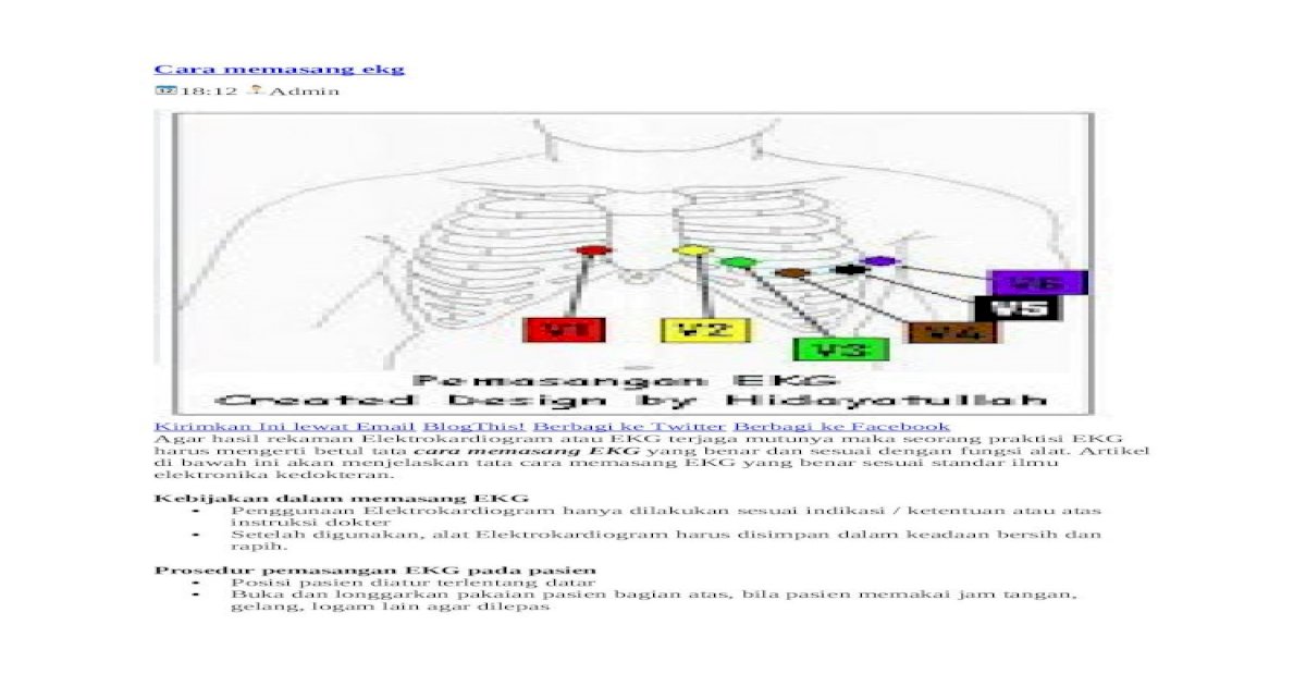 Detail Gambar Pemasangan Ekg Nomer 39