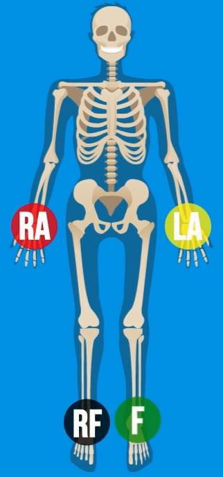 Detail Gambar Pemasangan Ekg Nomer 5