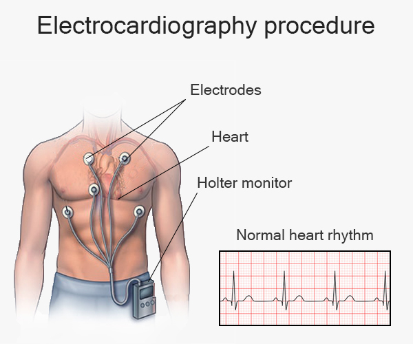 Detail Gambar Pemasangan Ekg Nomer 41