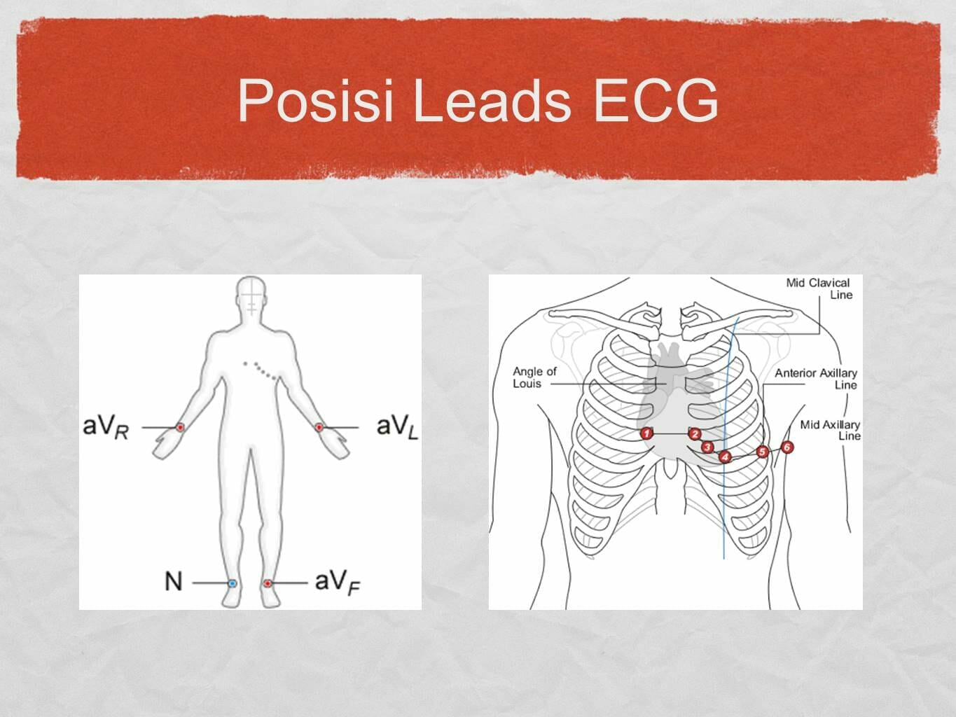 Detail Gambar Pemasangan Ekg Nomer 42