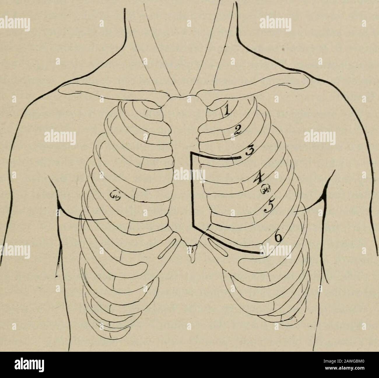 Detail Gambar Pemasangan Ekg Nomer 43