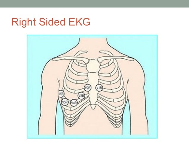 Detail Gambar Pemasangan Ekg Nomer 48