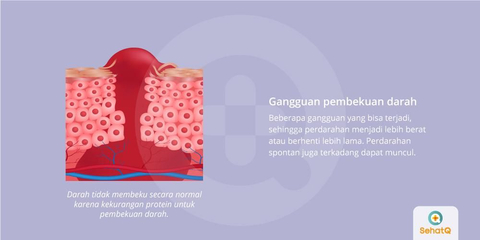 Detail Gambar Pembekuan Darah Nomer 32