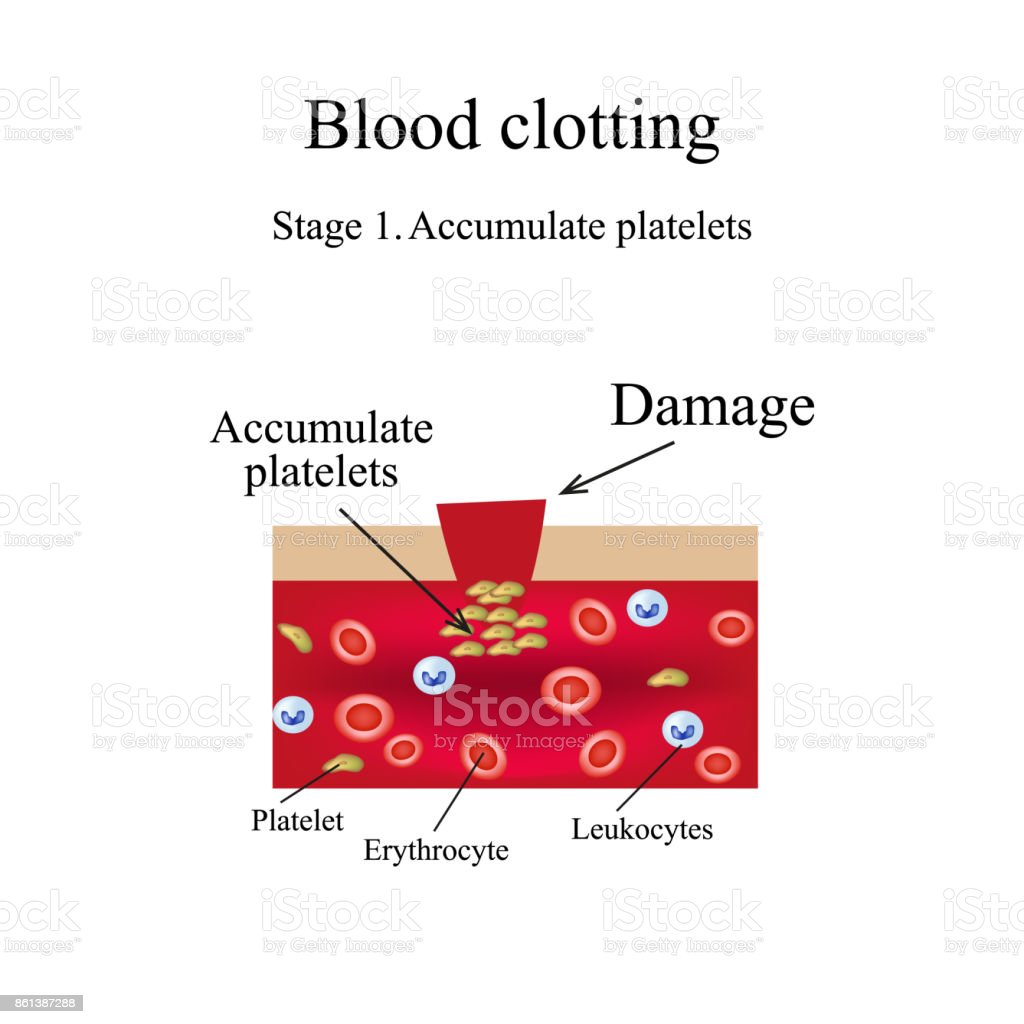 Detail Gambar Pembekuan Darah Nomer 47