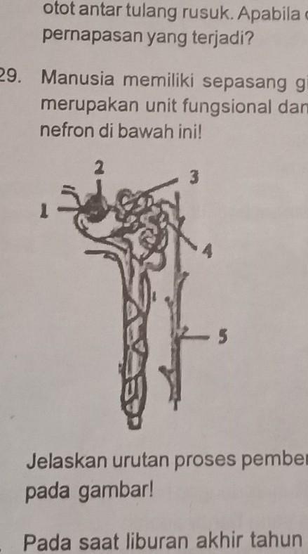 Detail Gambar Pembentukan Urin Nomer 46