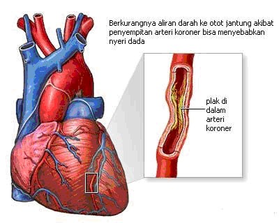 Detail Gambar Pembuluh Darah Jantung Nomer 38