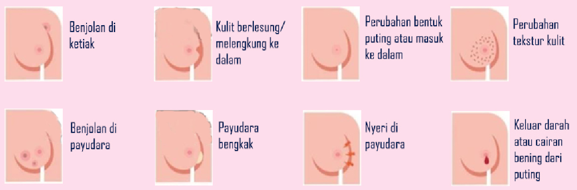 Detail Gambar Pemeriksaan Sadari Nomer 27