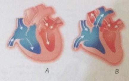 Detail Gambar Penampang Jantung Nomer 29