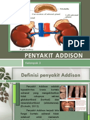 Detail Gambar Penyakit Addison Nomer 52