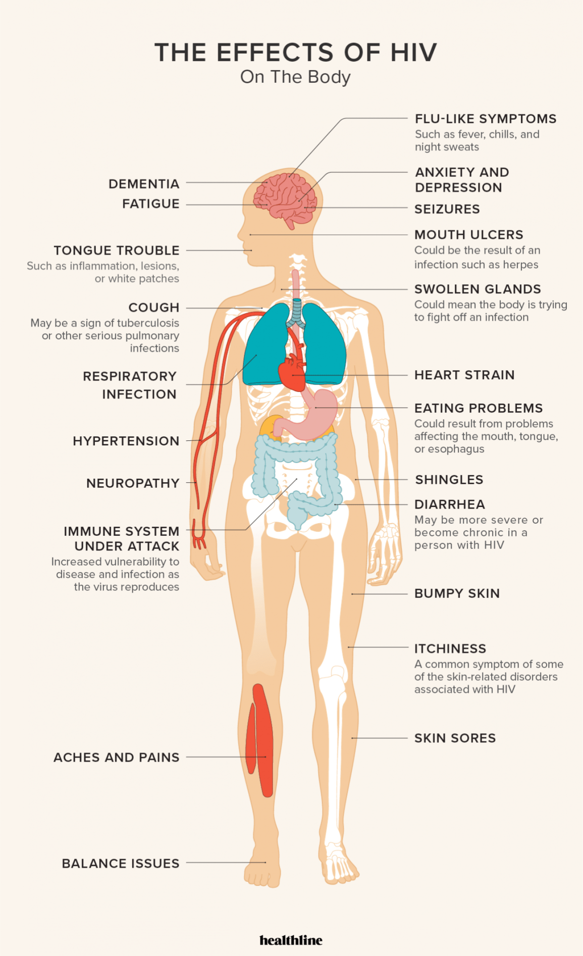 Detail Gambar Penyakit Aids Nomer 12