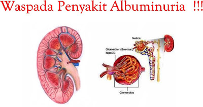 Detail Gambar Penyakit Albuminuria Nomer 28