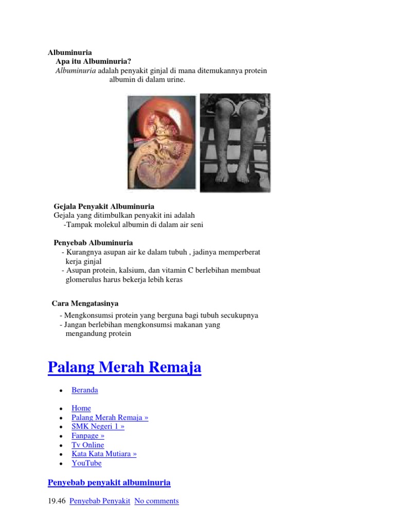 Detail Gambar Penyakit Albuminuria Nomer 32