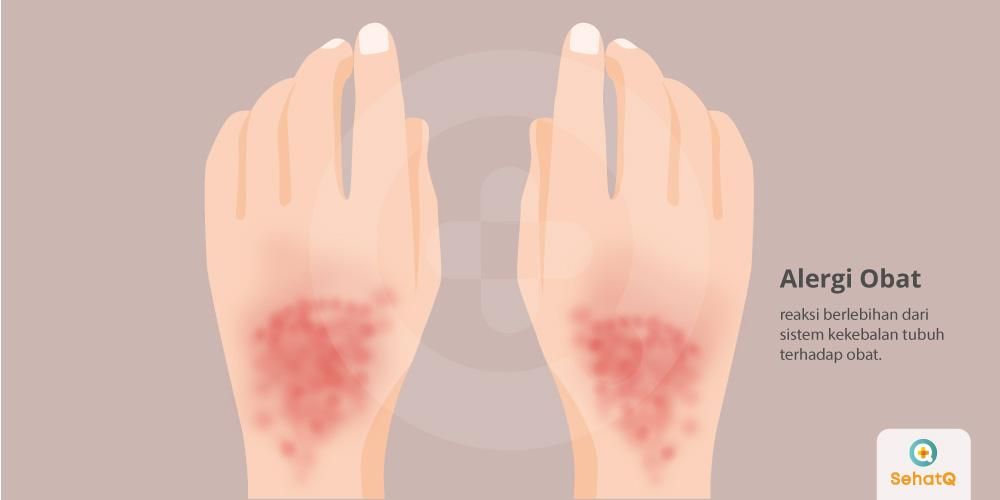 Detail Gambar Penyakit Alergi Nomer 18