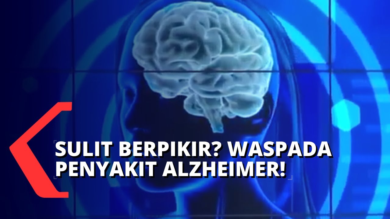 Detail Gambar Penyakit Alzheimer Nomer 23