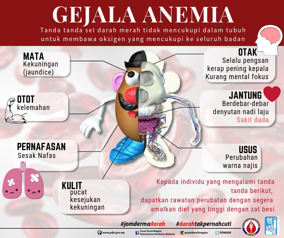 Detail Gambar Penyakit Anemia Nomer 19