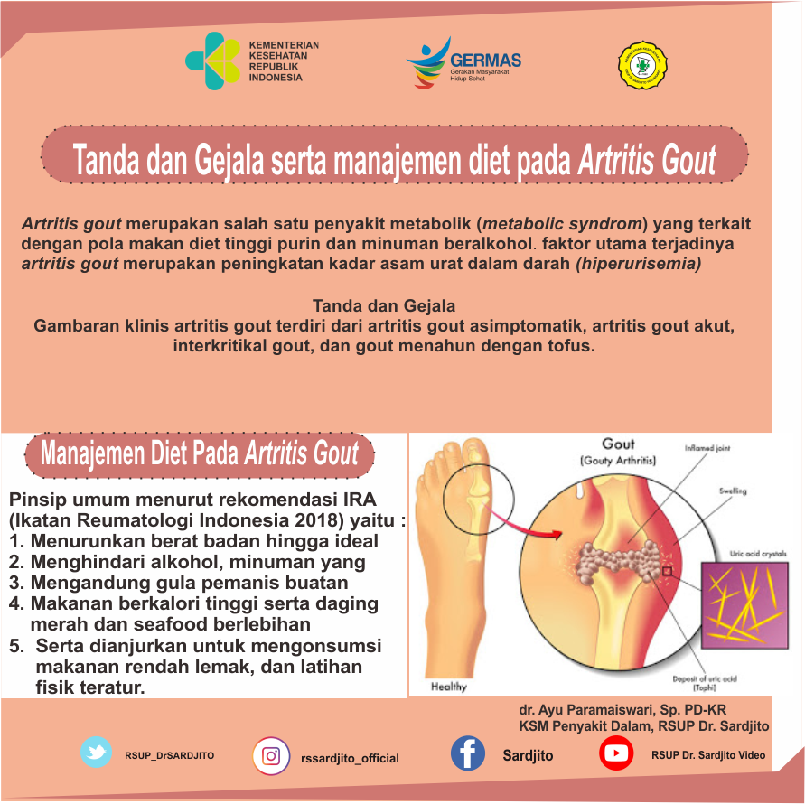 Detail Gambar Penyakit Artritis Nomer 22