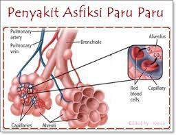 Detail Gambar Penyakit Asfiksi Nomer 2