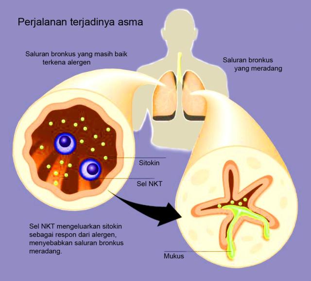 Detail Gambar Penyakit Asfiksi Nomer 24