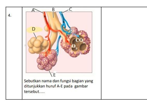 Detail Gambar Penyakit Asfiksi Nomer 34