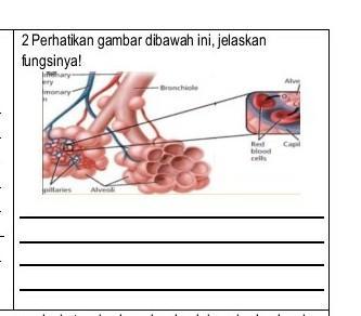 Detail Gambar Penyakit Asfiksi Nomer 35