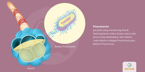 Detail Gambar Penyakit Asfiksi Nomer 39