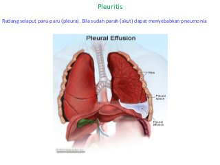 Detail Gambar Penyakit Asfiksi Nomer 48