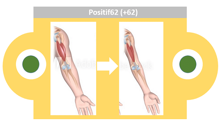 Detail Gambar Penyakit Atropi Nomer 21