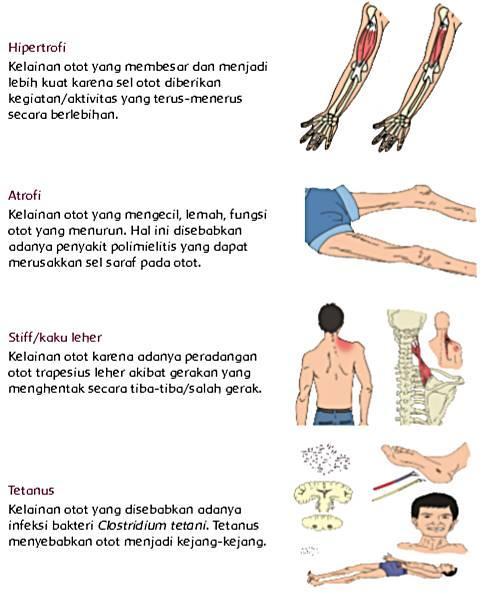 Detail Gambar Penyakit Atropi Nomer 23