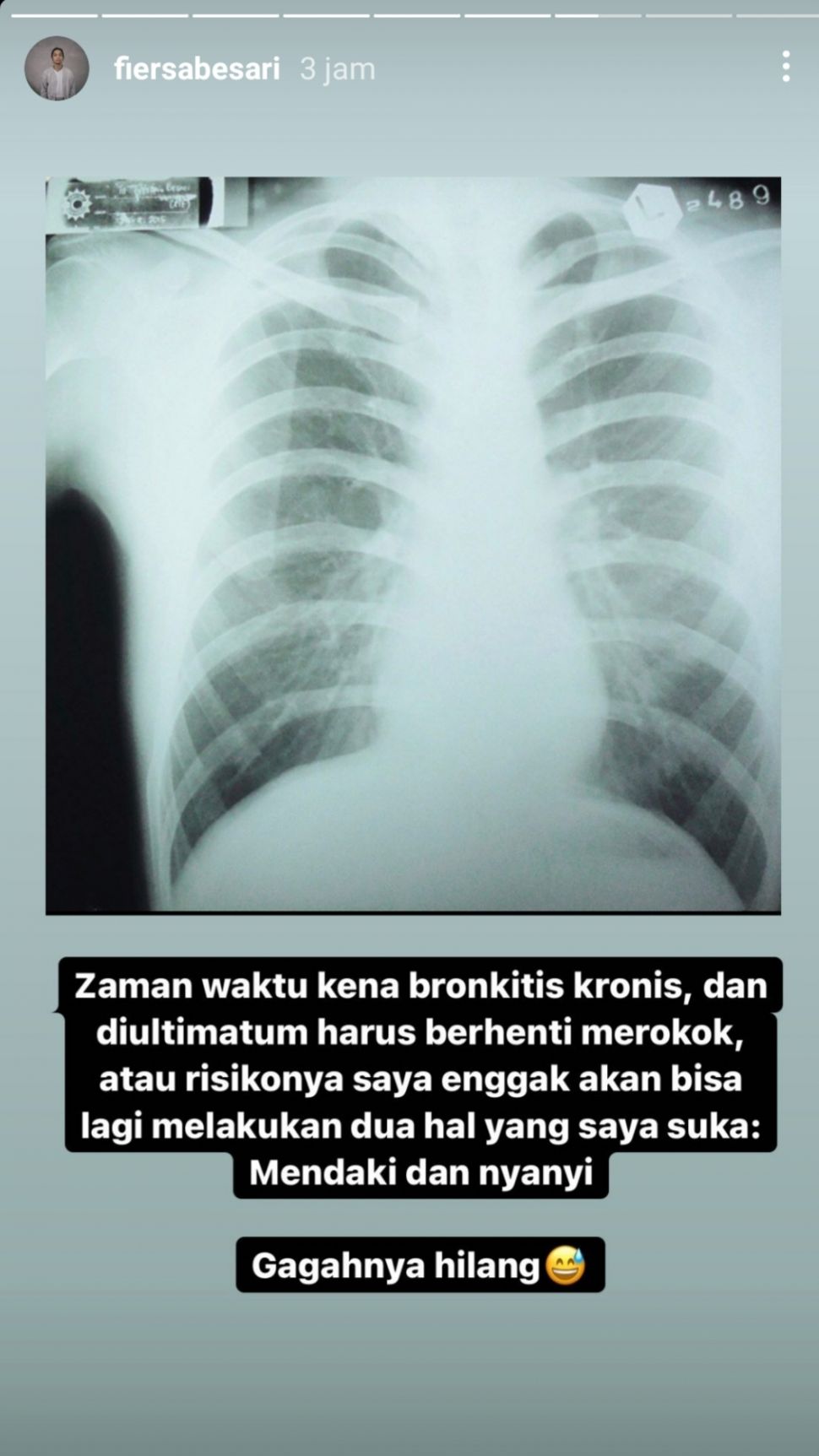 Detail Gambar Penyakit Bronkitis Nomer 25