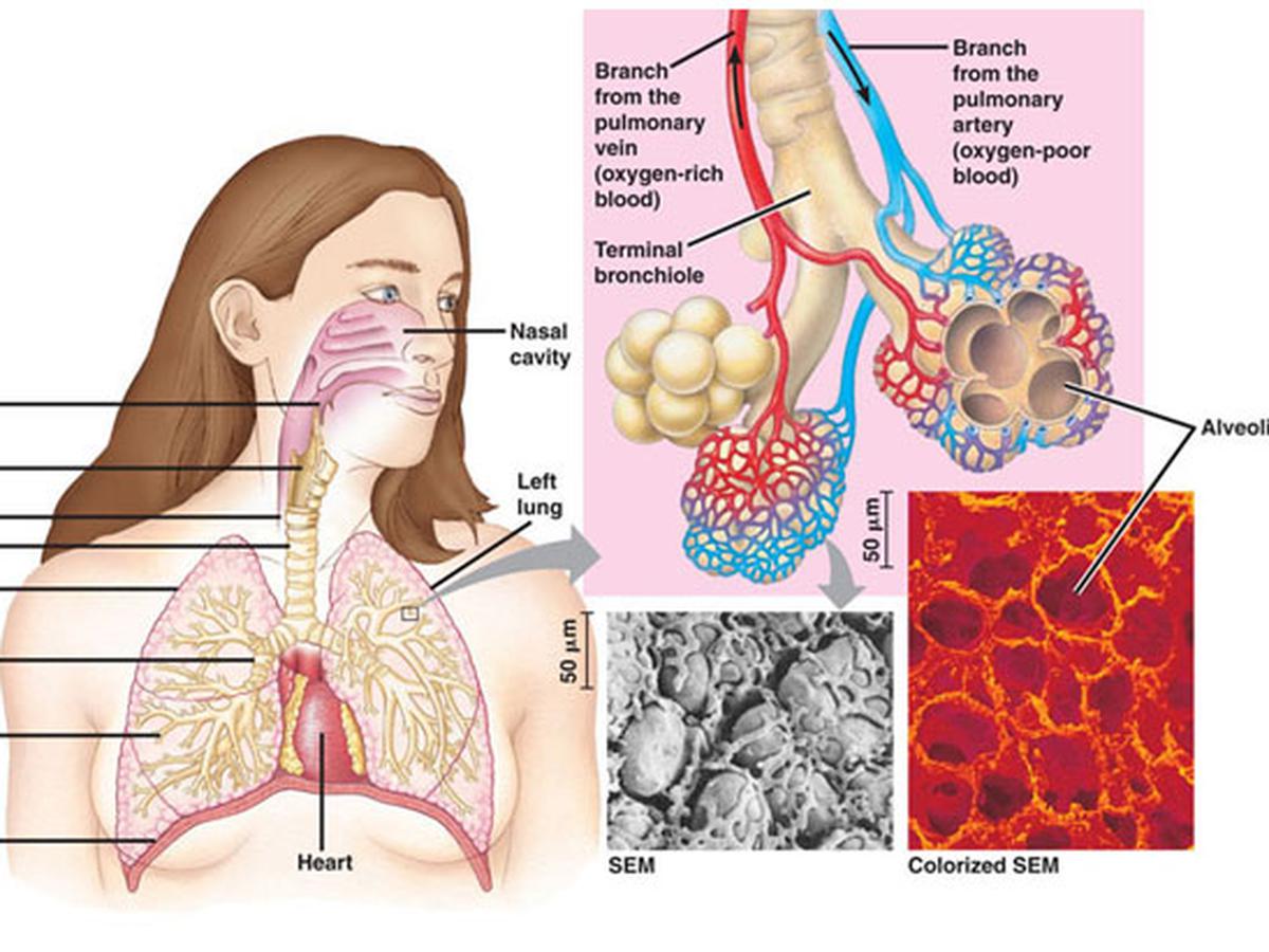 Detail Gambar Penyakit Bronkitis Nomer 8