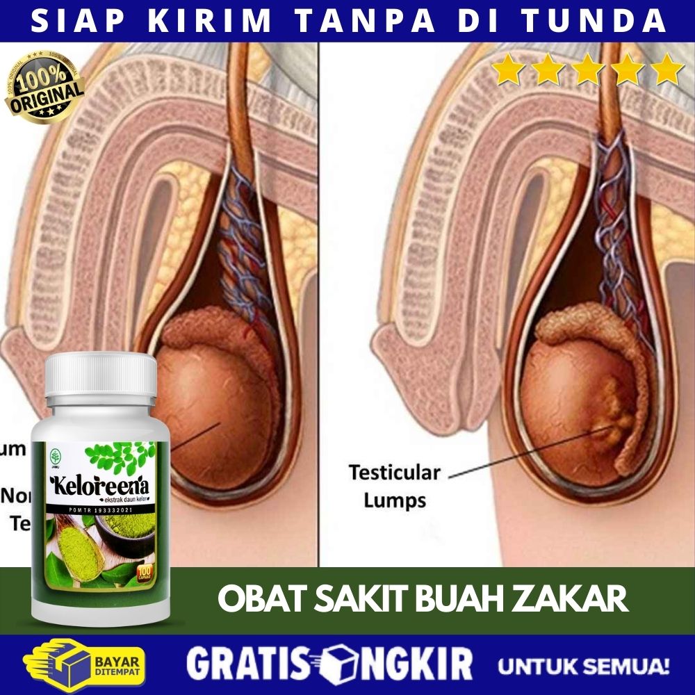 Detail Gambar Penyakit Buah Zakar Nomer 31