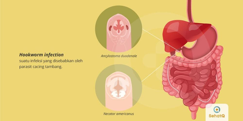Detail Gambar Penyakit Cacing Benang Nomer 7