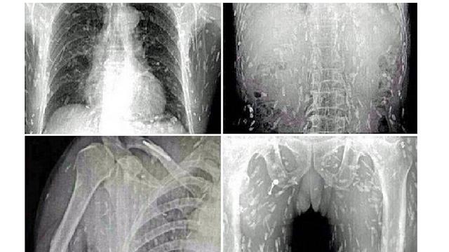 Detail Gambar Penyakit Cacing Ppita Nomer 9