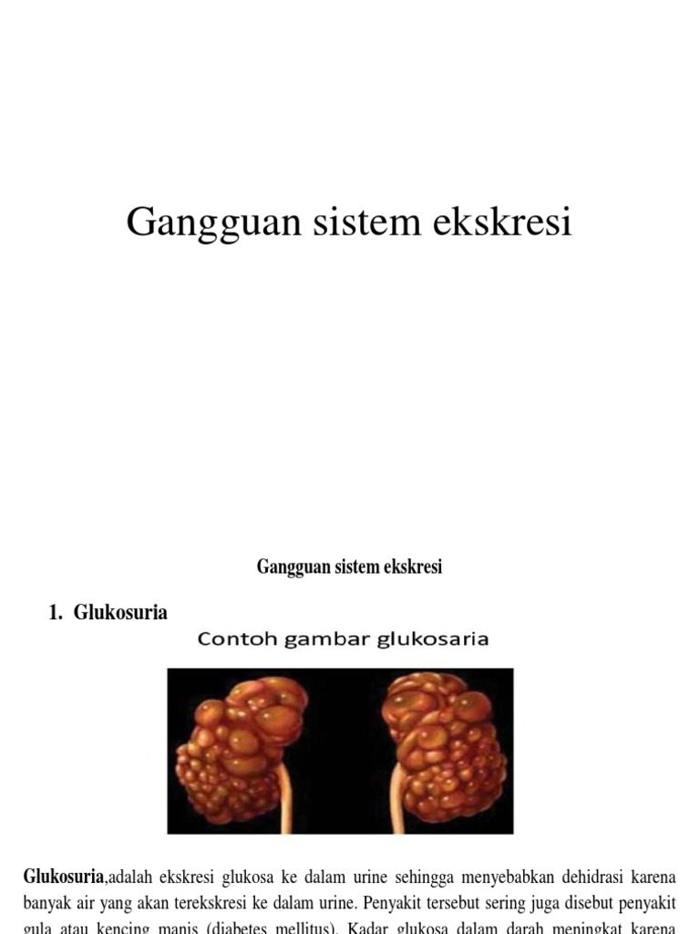 Detail Gambar Penyakit Diabetes Glukosuria Nomer 5