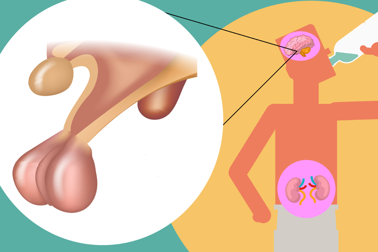 Detail Gambar Penyakit Diabetes Insipidus Nomer 4