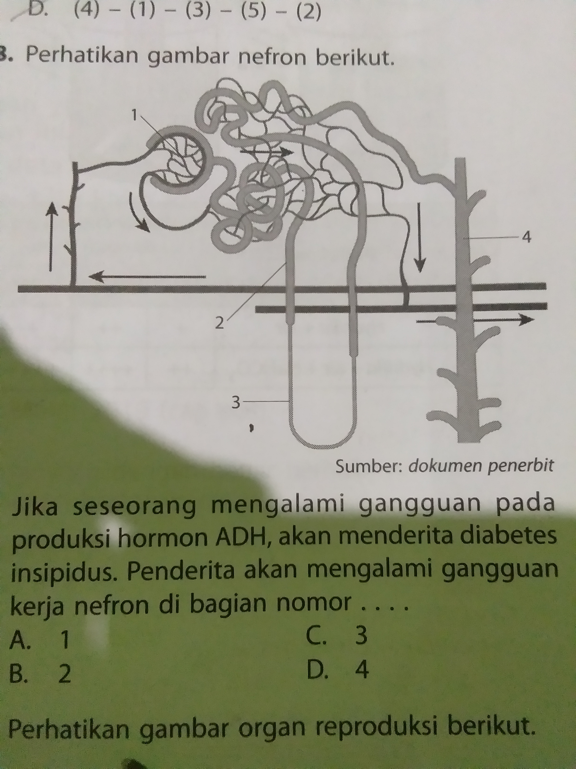 Detail Gambar Penyakit Diabetes Insipidus Nomer 44