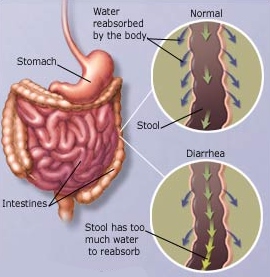 Detail Gambar Penyakit Diare Nomer 12