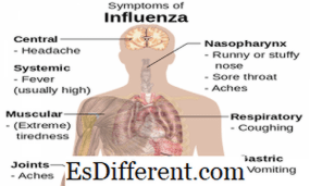 Detail Gambar Penyakit Flu Nomer 16