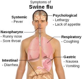 Detail Gambar Penyakit Flu Nomer 26