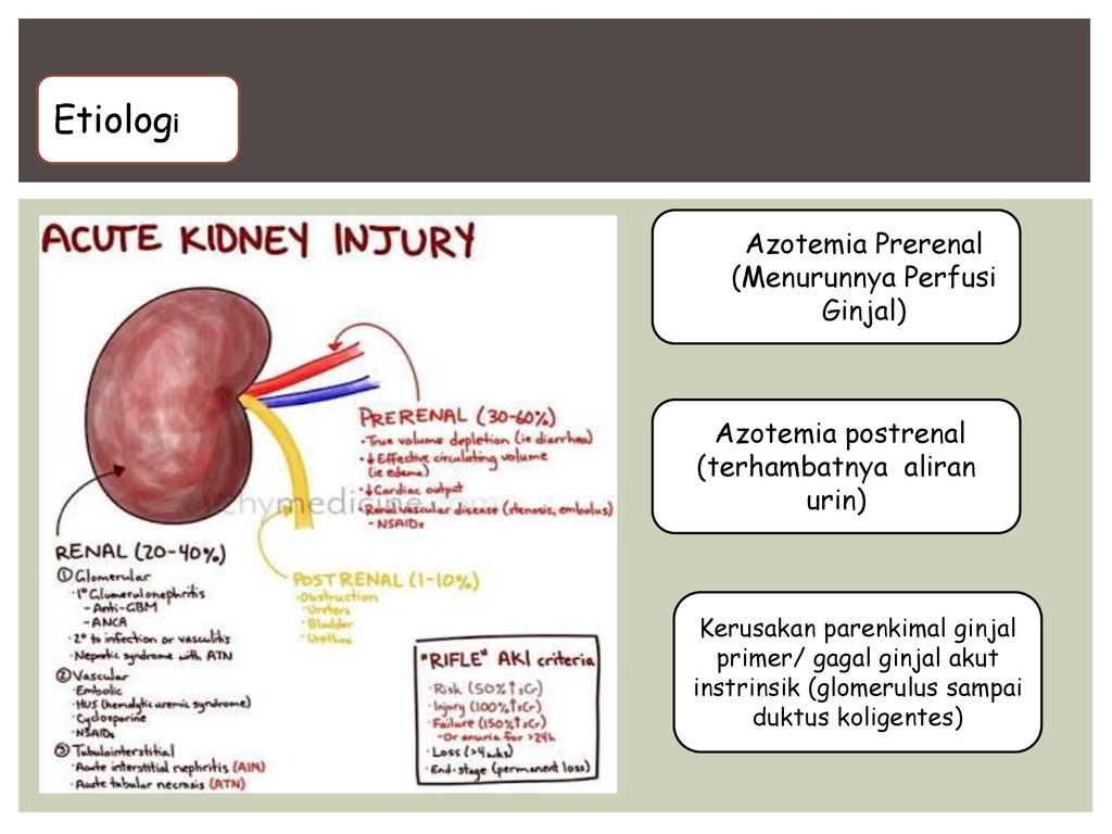 Detail Gambar Penyakit Ginjal Akut Nomer 26