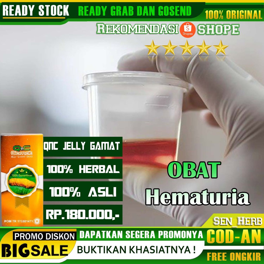 Detail Gambar Penyakit Hematuria Nomer 25