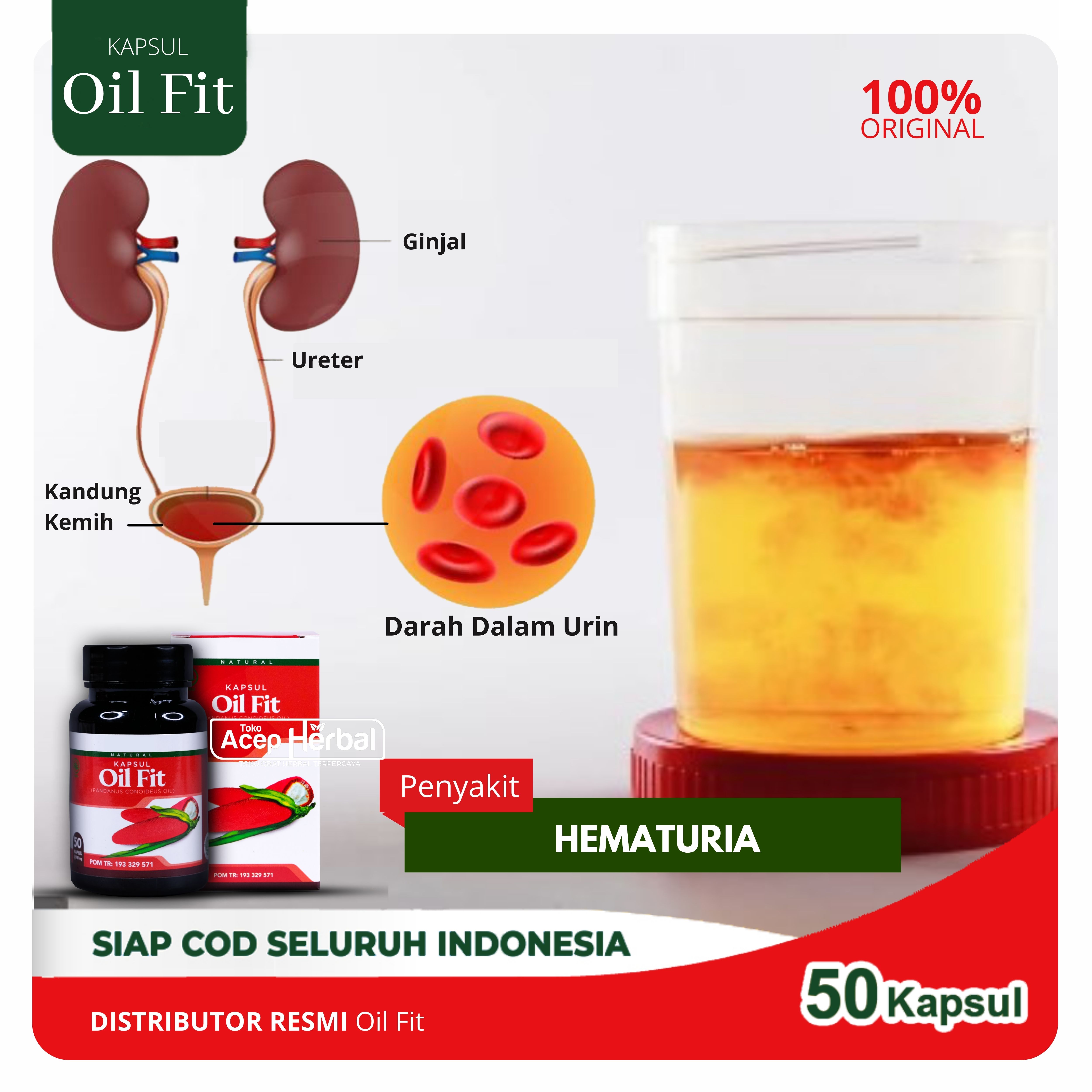 Detail Gambar Penyakit Hematuria Nomer 42