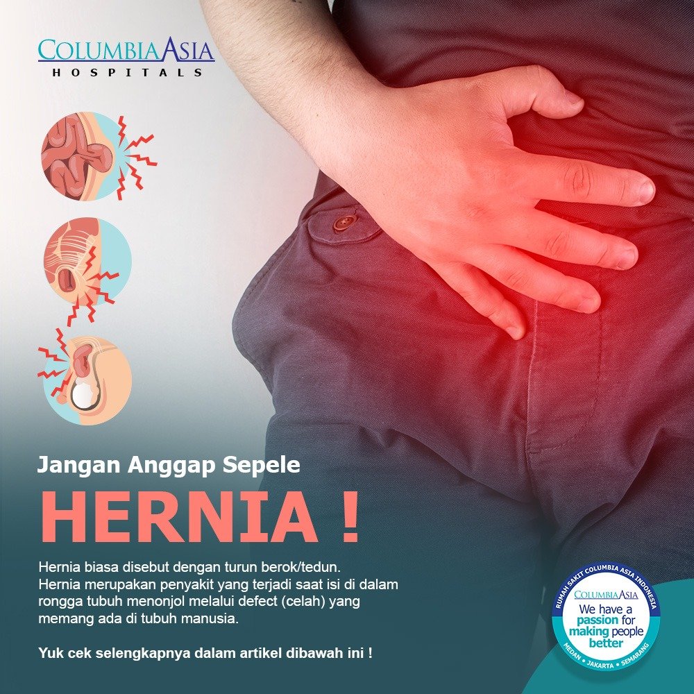Detail Gambar Penyakit Hernia Nomer 19