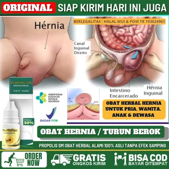 Detail Gambar Penyakit Hernia Nomer 46