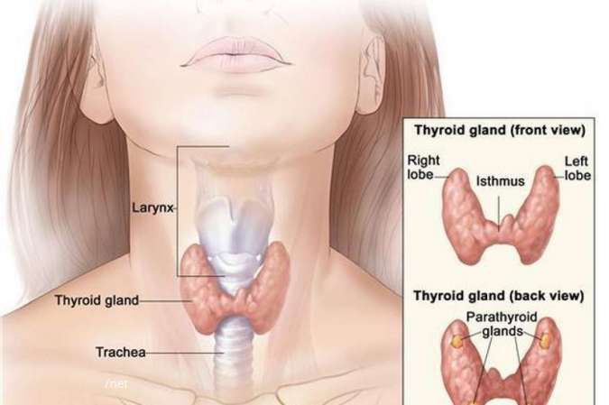 Detail Gambar Penyakit Hipertiroid Nomer 4